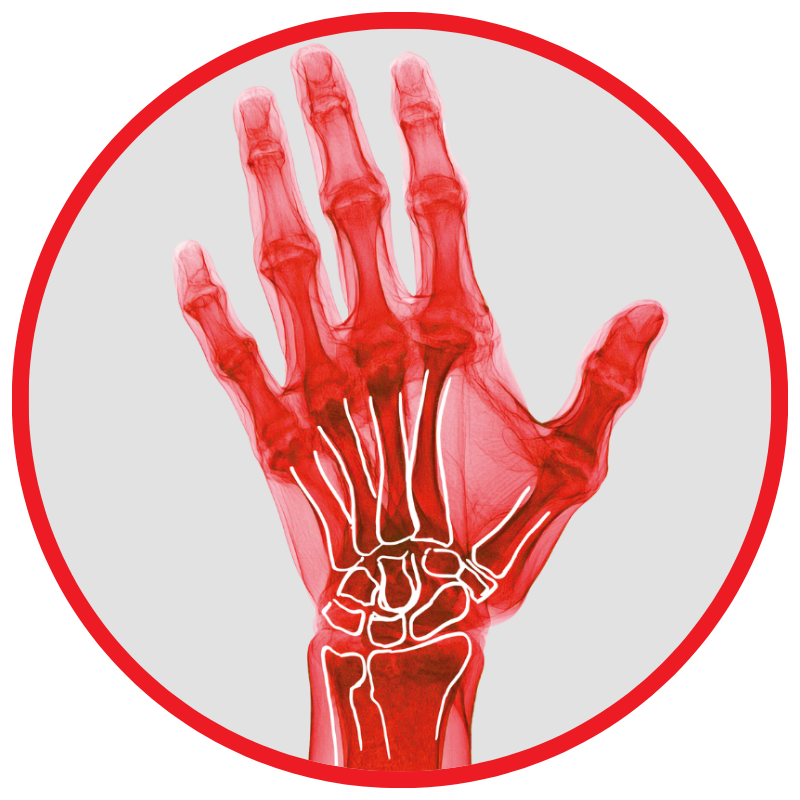 fisioterapia mano rimini